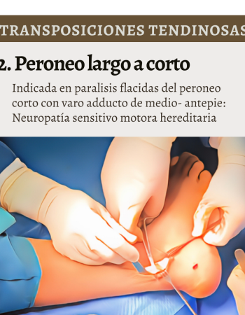 transposiciones tendinosas 3