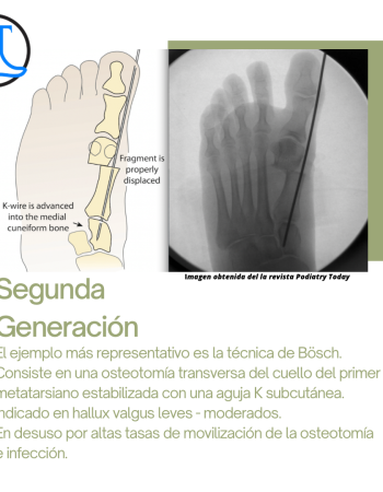 Evolucion-cirugia-percutanea-IV