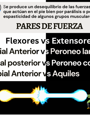 Porque se deforma un pie neurológico - 2