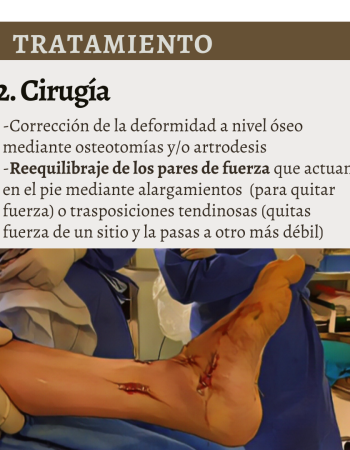 porque se deforma un pie neurológico - 4