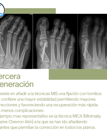 Evolucion-cirugia-percutanea-VI