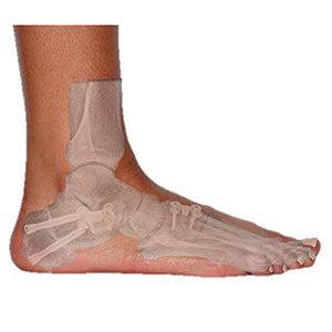 raul-torre-preservacion-articular-tratamiento