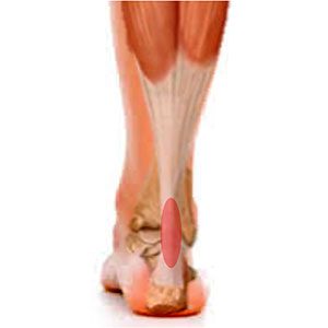 raul-torre-tendinopa-patologia